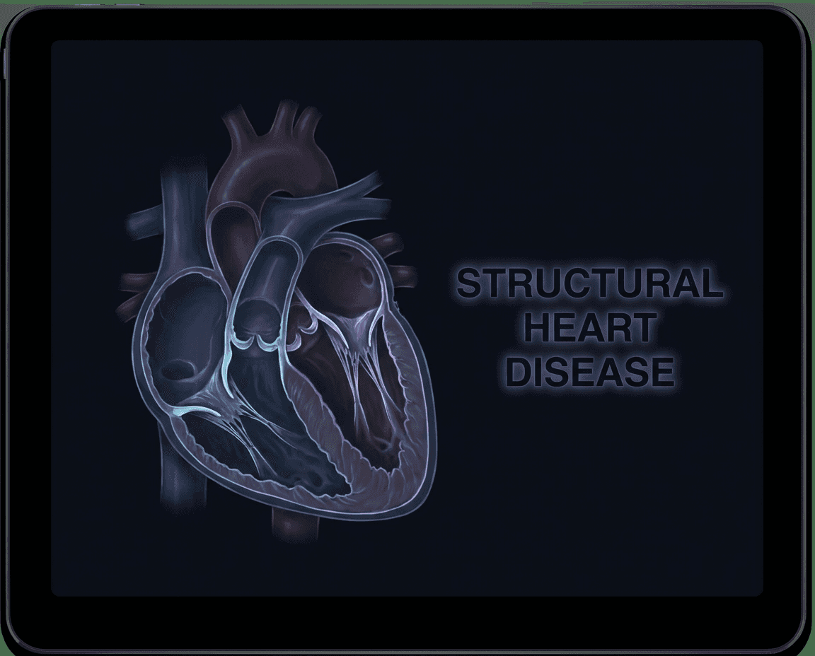 Structural Heart Clinic